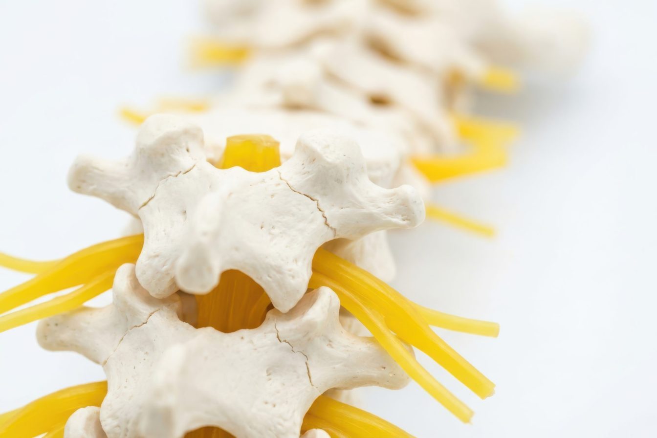 Human spine model with vertebrae and yellow nerves, used for anatomical study and medical illustration.